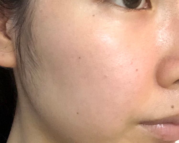 マトリックスエキス　お試し　navis 12日目